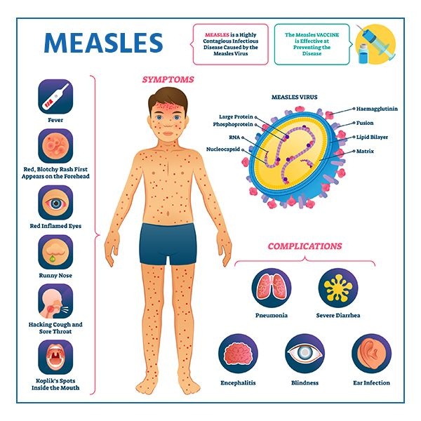 Measles Vaccination